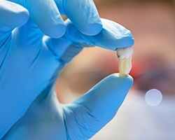 Extracted tooth in Rolling Meadows