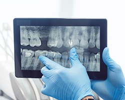 Digital dental x-rays on tablet computer