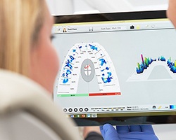 Cavity detection scan on computer