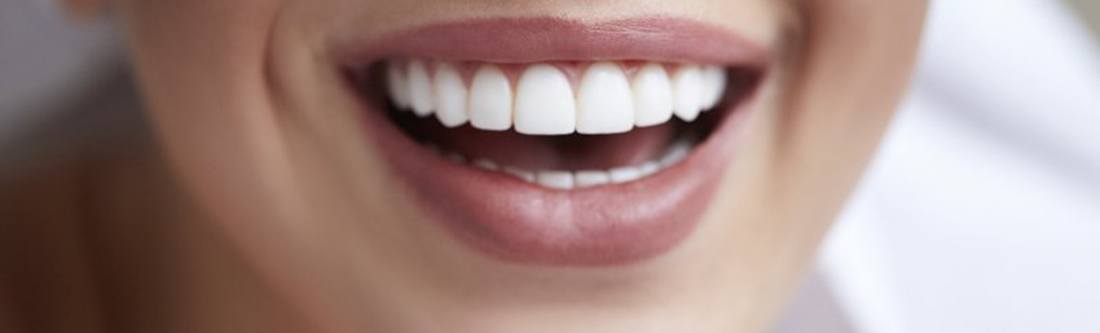 close up of person smiling after getting dental bonding in Rolling Meadows 