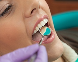 Closeup of patient receiving dental treatment