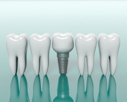Row of teeth with a dental implant in the center