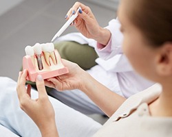 dentist showing a patient a dental implant model 