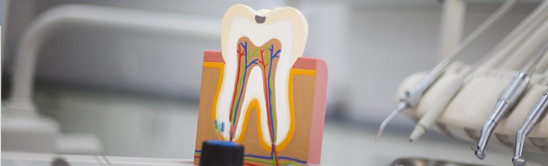 Model of the inside of the tooth